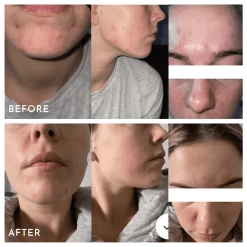 Aspect Extreme B 17 -Care Products Store AspectExtremeB17BeforeAndAfters