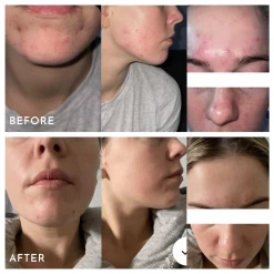 Extreme B17 -Care Products Store AspectExtremeB17BeforeAndAfters b1a0cecd d7e1 4147 862c 3b14d68fbce8