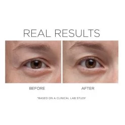 Cosmedix Opti Crystal -Care Products Store CosmedixOptiEyeCrystalbeforeandafter