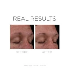 Cosmedix Serum 16 13 Cosmedix Serum 16 -Care Products Store CosmedixSerum16beforeandafter