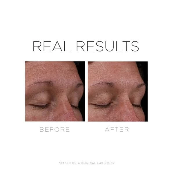 Cosmedix Serum 16 5 Cosmedix Serum 16 - Image 5