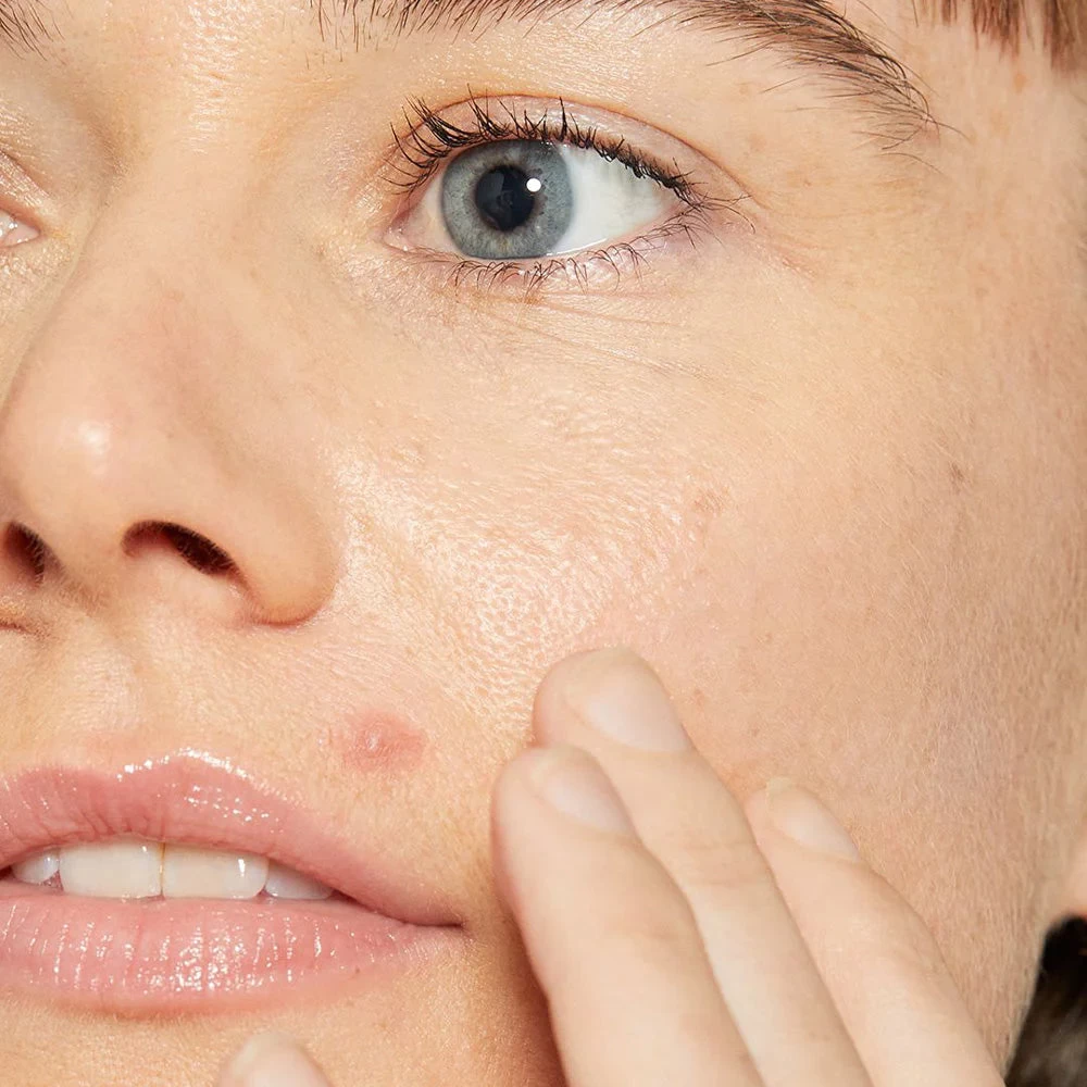 Dermalogica Deep Breakout Liquid Patch 5 Dermalogica Deep Breakout Liquid Patch - Image 5