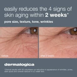 Dermalogica Dynamic Skin Retinol Serum -Care Products Store Dynamic Skin Retinol Serum Dermalogica before And after