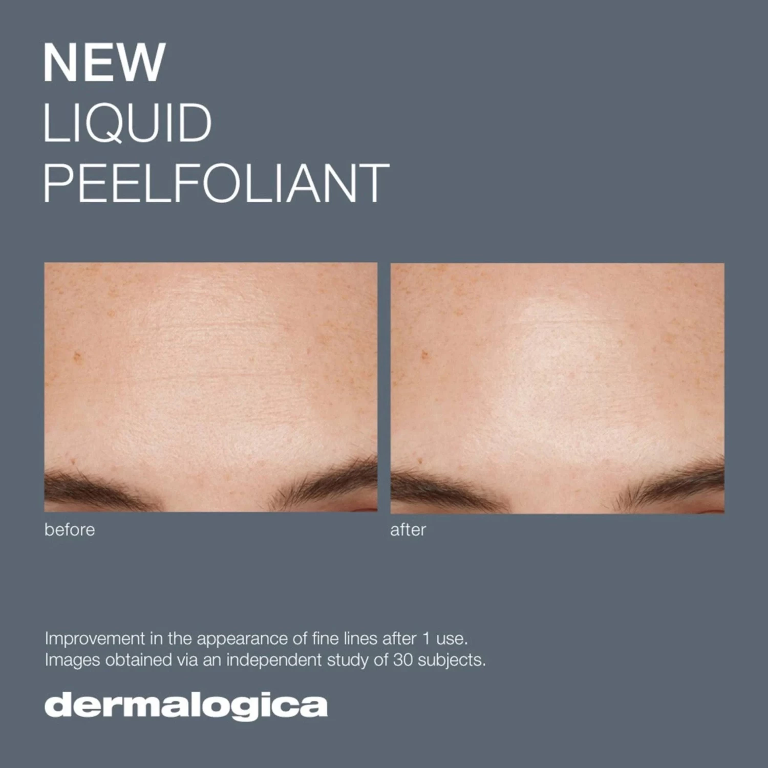 Dermalogica Liquid Peelfoliant 8 Dermalogica Liquid Peelfoliant - Image 8