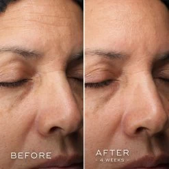 Medik8 C-Tetra Luxe 18 Medik8 C-Tetra Luxe -Care Products Store Medik8C TetraLuxeBefore After