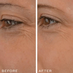 Medik8 Crystal Retinal 1 -Care Products Store Medik8CrystalRetinal1beforeandafter
