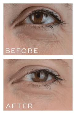 Medik8 Crystal Retinal 3 -Care Products Store Medik8CrystalRetinal3beforeandafter