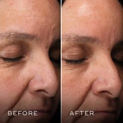 Medik8 H.E.O Mask -Care Products Store Medik8H.E.OMaskBefore After