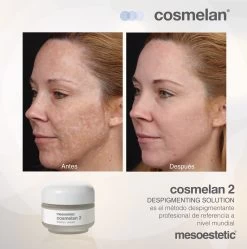 Mesoestetic Cosmelan 2 Maintenance Cream -Care Products Store Mesoestetic Cosmelan 2 Maintenence Cream