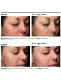 PCA Skin HydraMatte -Care Products Store PCASkinHydraMatteOnline