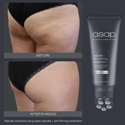 Asap Cellulite And Skin Firming Treatment -Care Products Store asapcelluliteandskinfirmingtreatment200ml beforeandafter