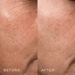 Medik8 Crystal Retinal 3 -Care Products Store before after 2 medik8 howtoUseMedik8CrystalRetinal