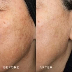 Medik8 Crystal Retinal 10 -Care Products Store crystal 10 retinal