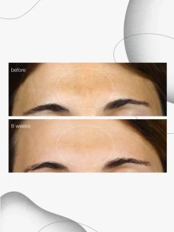 Dermalogica Powerbright Dark Spot Serum 17 Dermalogica Powerbright Dark Spot Serum -Care Products Store dermalogica power bright dark spot serum 30ml