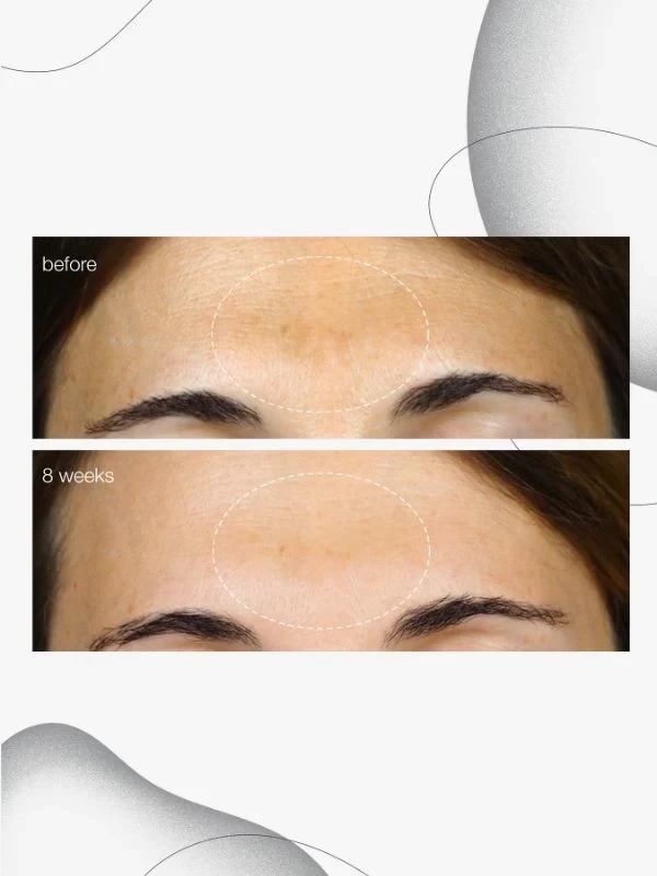 Dermalogica Powerbright Dark Spot Serum 3 Dermalogica Powerbright Dark Spot Serum - Image 3