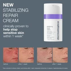Dermalogica Stabilizing Repair Cream -Care Products Store dermalogica stabilizing repair cream before and after