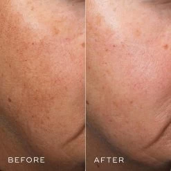 Medik8 Crystal Retinal 10 -Care Products Store medik8 crystal 10 before after