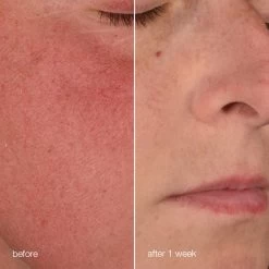 Dermalogica Stabilizing Repair Cream -Care Products Store stabilizing repair cream